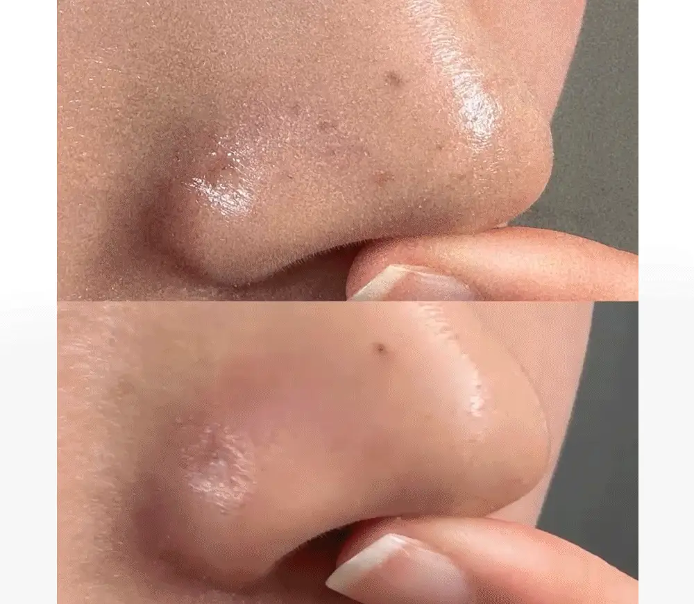 [녹두폼증정] 비플레인 녹두 클렌징오일 200ml 더블 기획 (+클렌징폼 20ml) 상세페이지 6